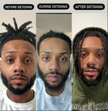 Rich Love before, during and after detoxing